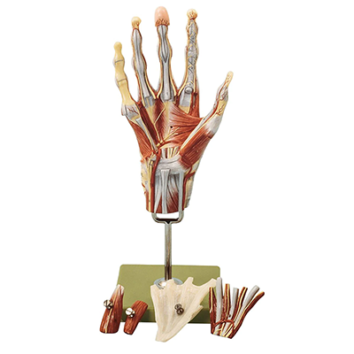 Upper Extremities